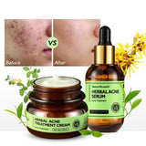 Herbal Facial Skin Care 2PCS/Set