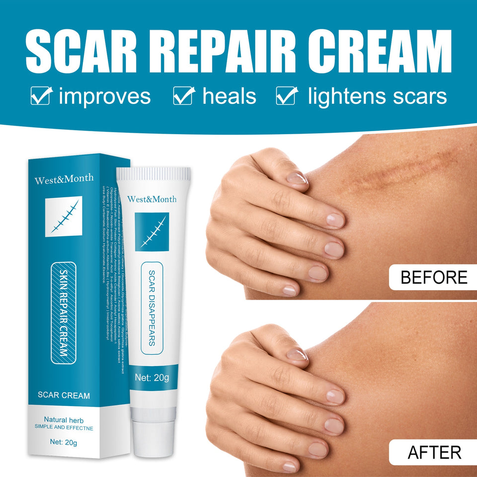 Herbal Scar Removal Cream Skin Care