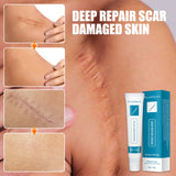 Herbal Scar Removal Cream Skin Care